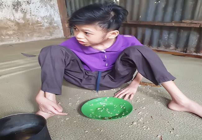 Miris! Sandi Duha Anak Berkebutuhan Khusus Terlantar, Butuh Uluran Tangan